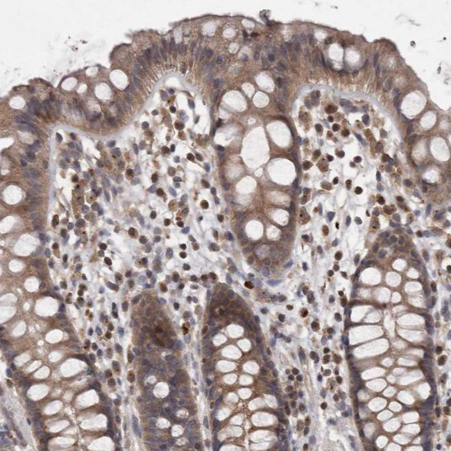 PCM1 Antibody in Immunohistochemistry (IHC)