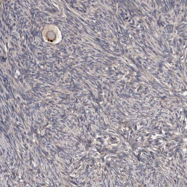 PCM1 Antibody in Immunohistochemistry (IHC)