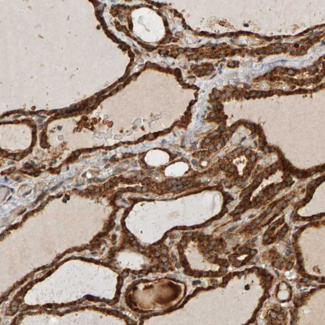 ZFAND1 Antibody in Immunohistochemistry (IHC)