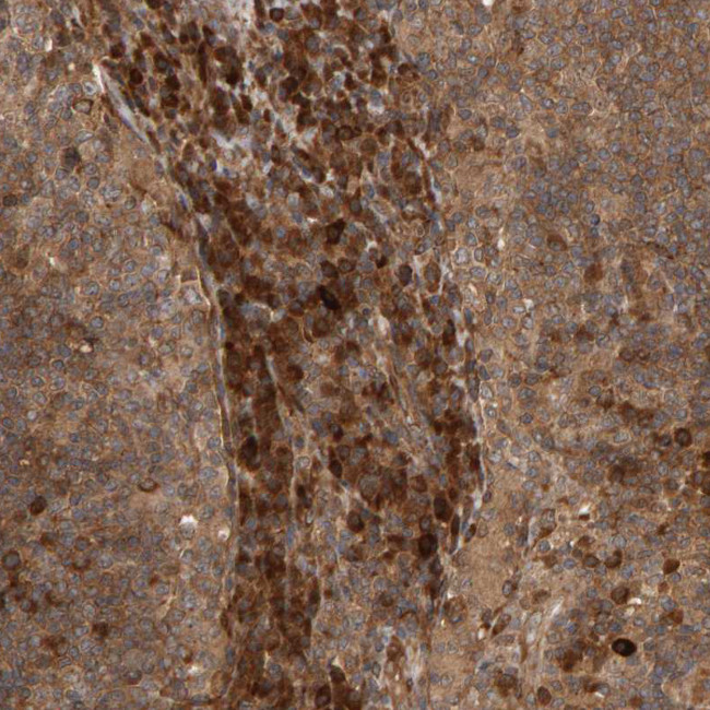 ZFAND1 Antibody in Immunohistochemistry (IHC)