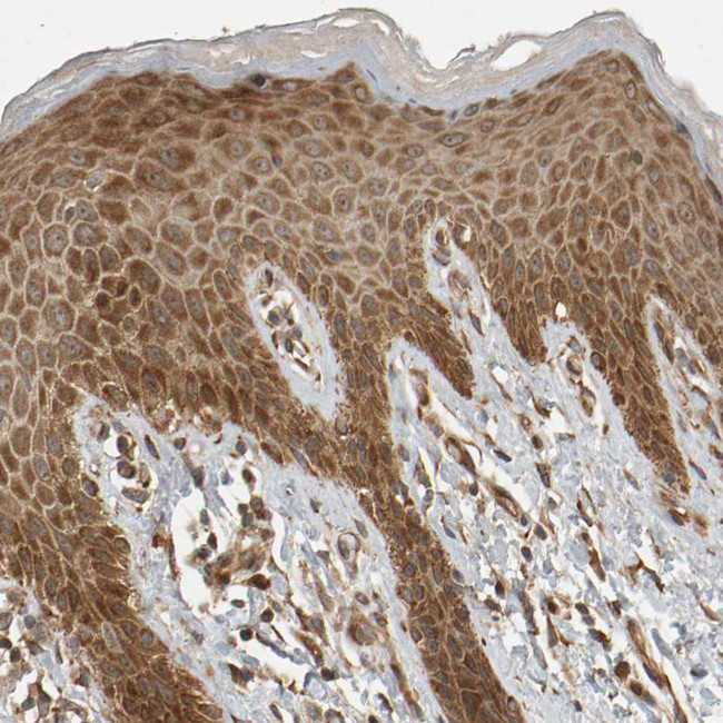 ZFAND1 Antibody in Immunohistochemistry (IHC)