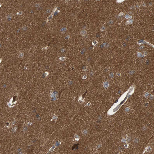 V-ATPase H Antibody in Immunohistochemistry (IHC)