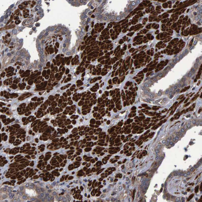 V-ATPase H Antibody in Immunohistochemistry (IHC)