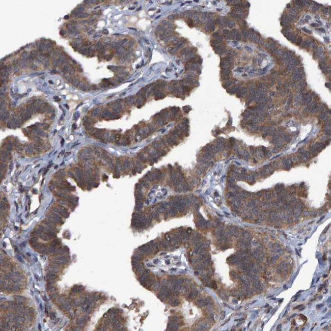 V-ATPase H Antibody in Immunohistochemistry (IHC)