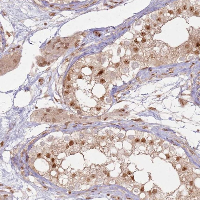 KLHL36 Antibody in Immunohistochemistry (IHC)