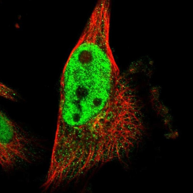 SCRN2 Antibody in Immunocytochemistry (ICC/IF)