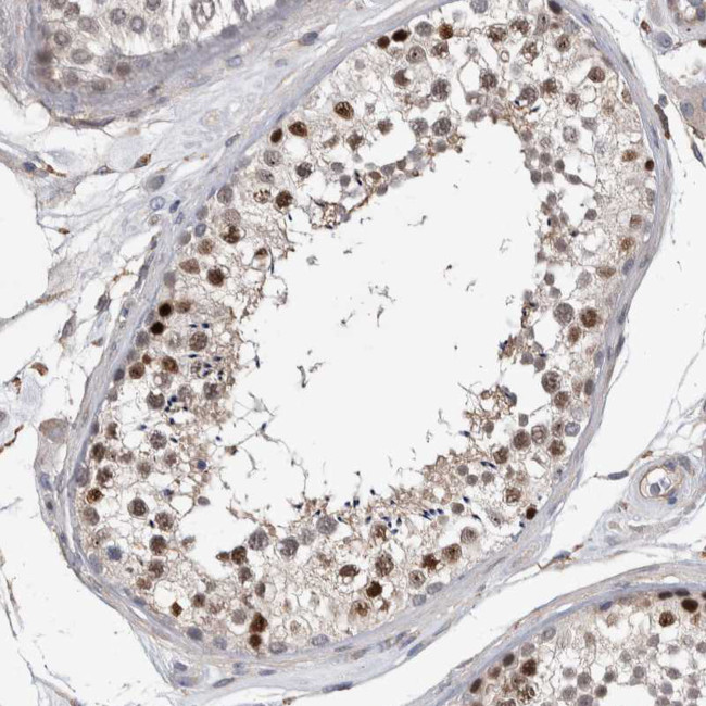 ACRC Antibody in Immunohistochemistry (IHC)