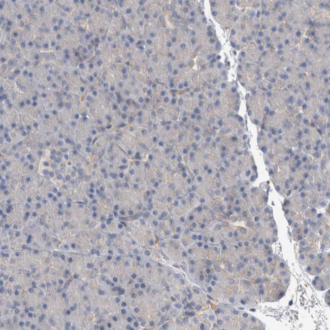 ACRC Antibody in Immunohistochemistry (IHC)