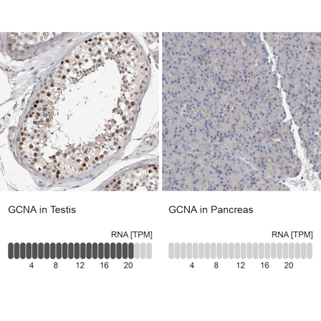 ACRC Antibody