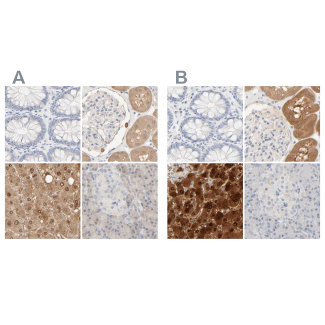 HRSP12 Antibody in Immunohistochemistry (IHC)