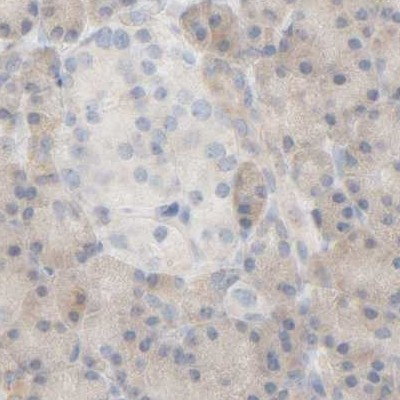 HRSP12 Antibody in Immunohistochemistry (IHC)