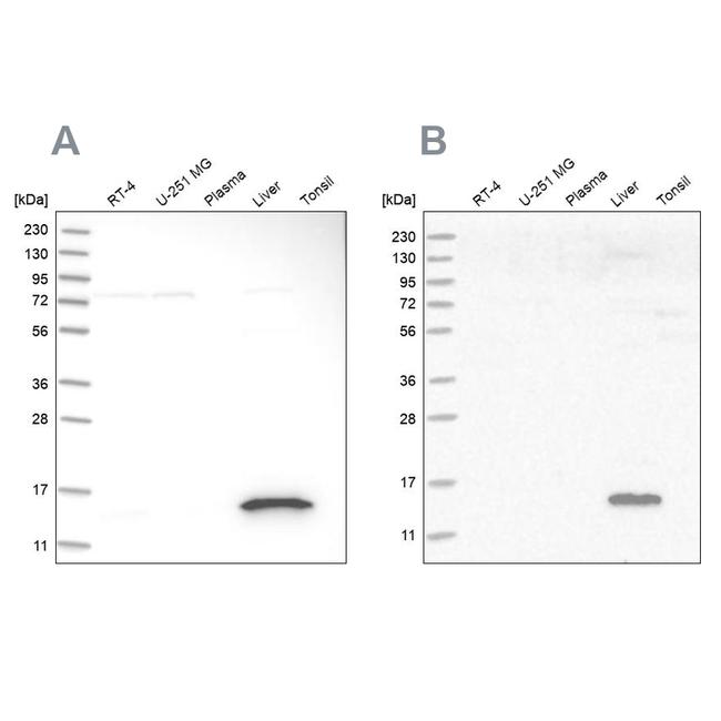 HRSP12 Antibody in Western Blot (WB)