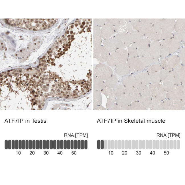 ATF7IP Antibody