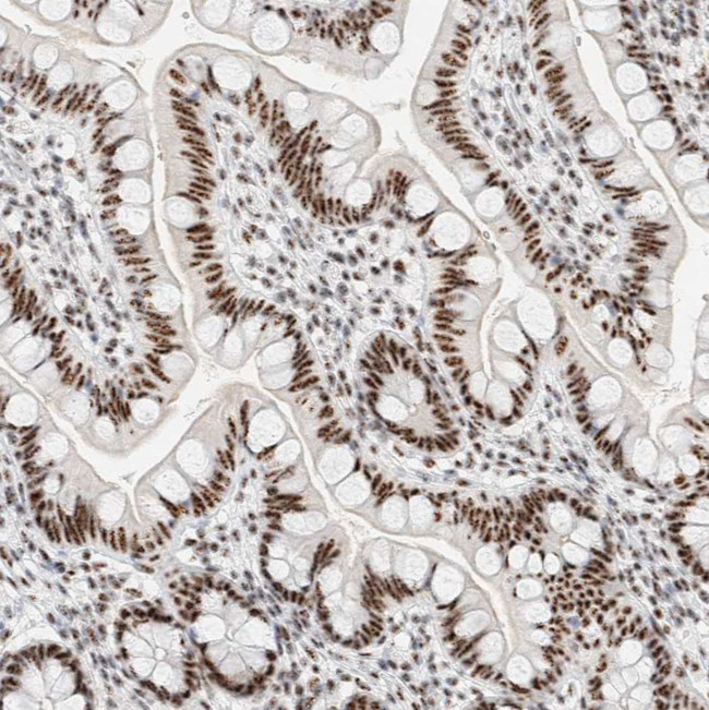 SON Antibody in Immunohistochemistry (IHC)