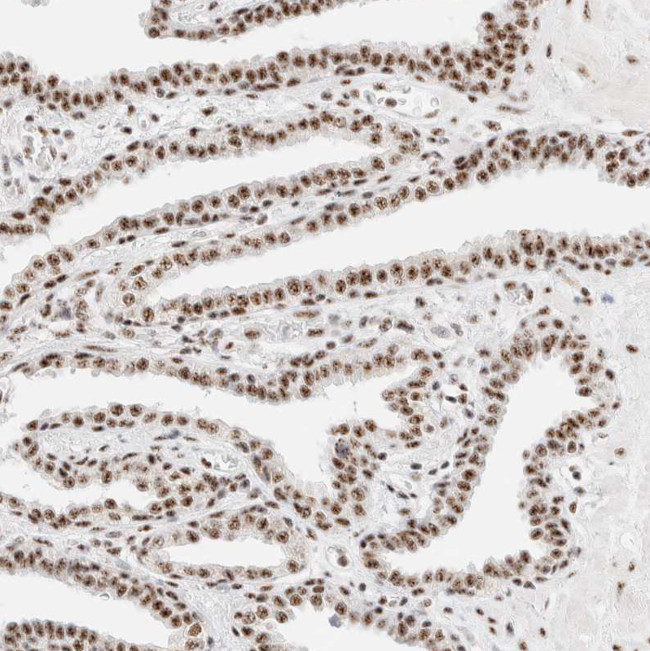 SON Antibody in Immunohistochemistry (IHC)