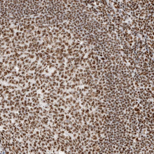 SON Antibody in Immunohistochemistry (IHC)