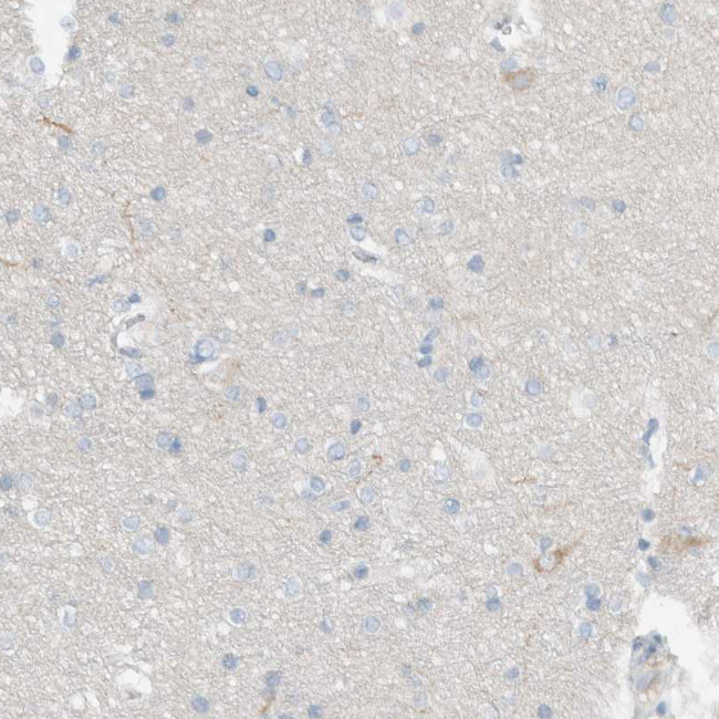 DUOX1 Antibody in Immunohistochemistry (IHC)