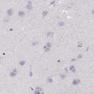 RUNDC3A Antibody in Immunohistochemistry (IHC)