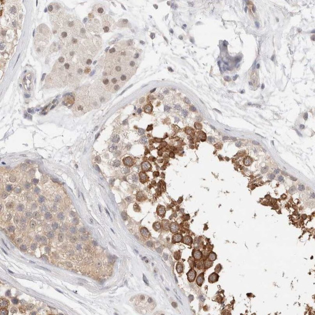 C17orf97 Antibody in Immunohistochemistry (IHC)