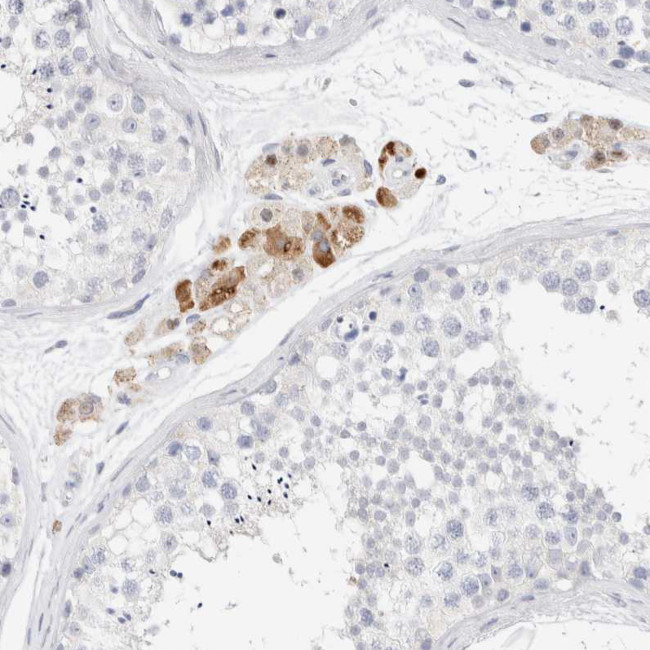 GADD45G Antibody in Immunohistochemistry (IHC)