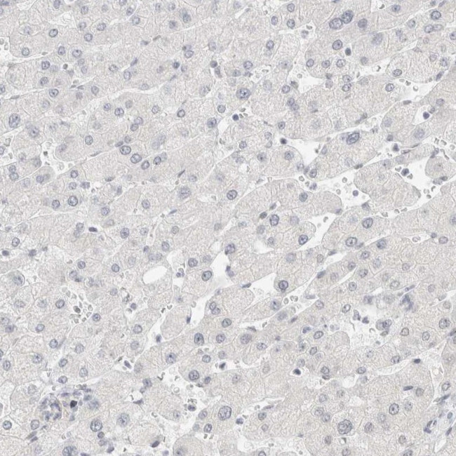 CDH17 Antibody in Immunohistochemistry (IHC)