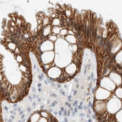 CDH17 Antibody in Immunohistochemistry (IHC)