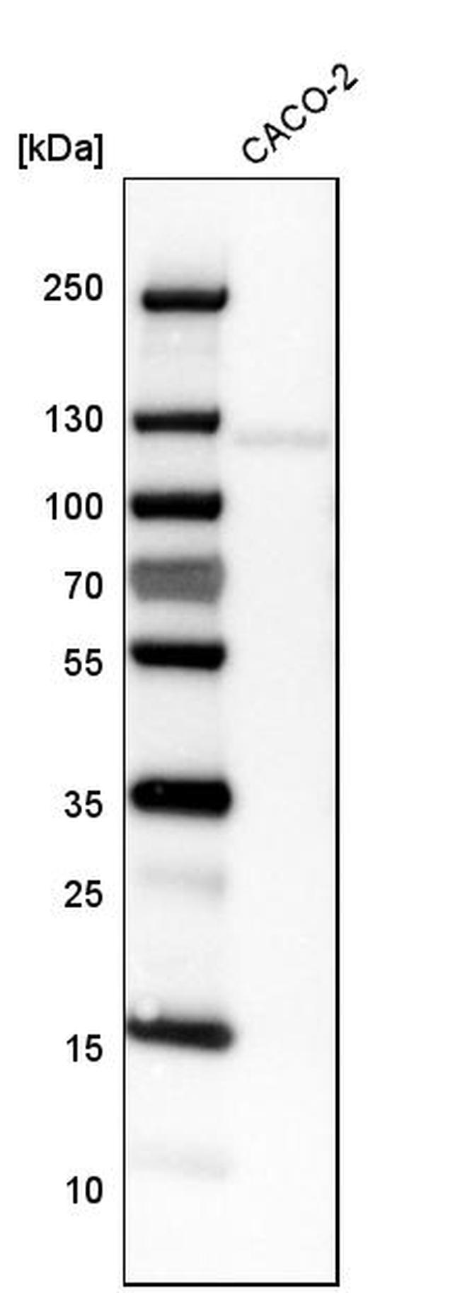 CDH17 Antibody in Western Blot (WB)