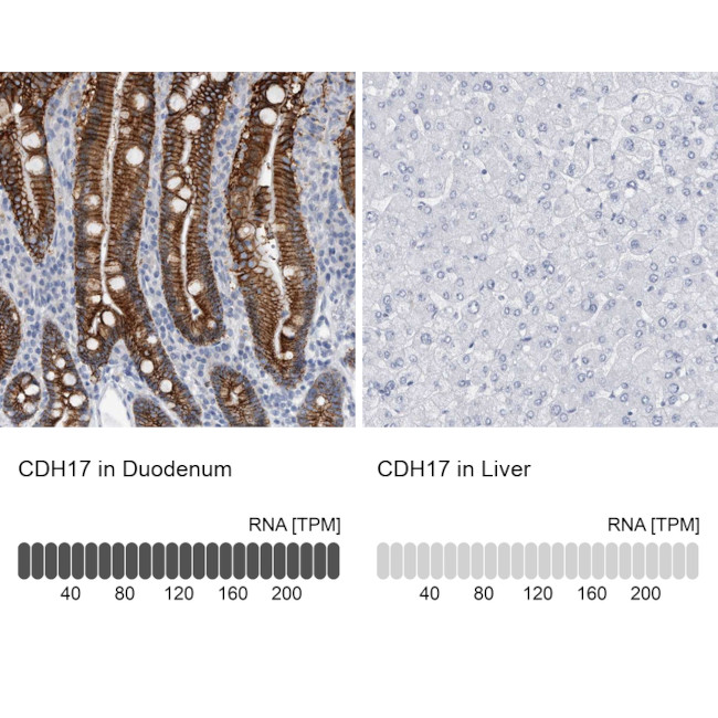 CDH17 Antibody in Immunohistochemistry (IHC)