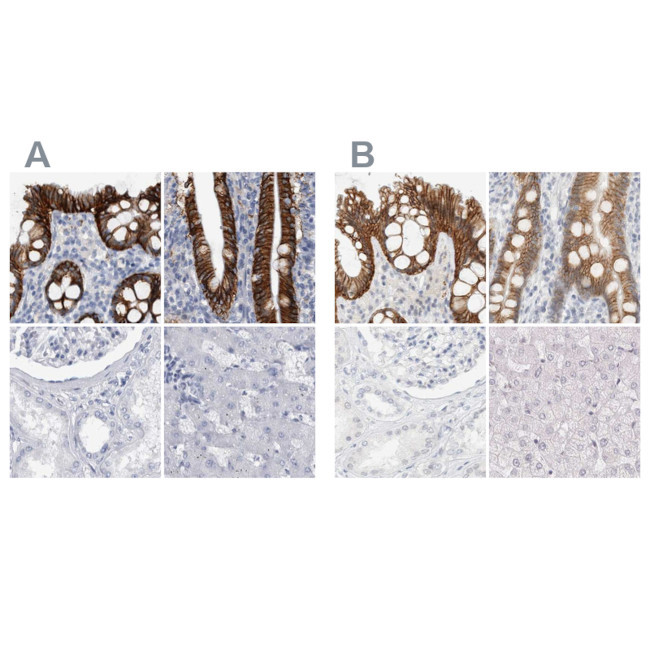 CDH17 Antibody in Immunohistochemistry (IHC)