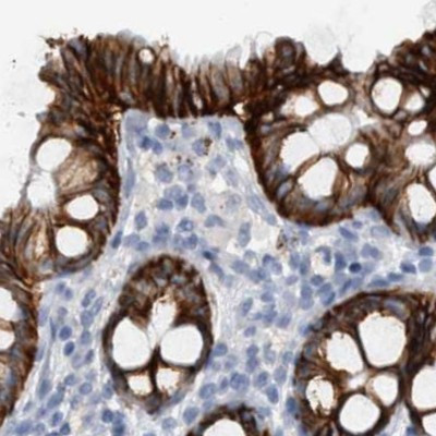 CDH17 Antibody in Immunohistochemistry (IHC)