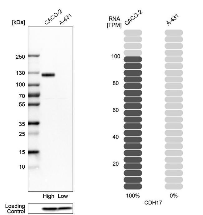 CDH17 Antibody in Western Blot (WB)