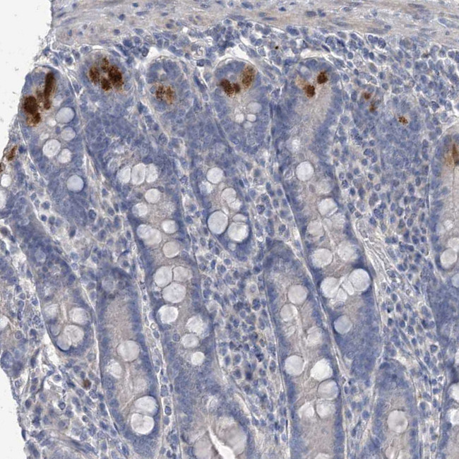 TTYH1 Antibody in Immunohistochemistry (IHC)