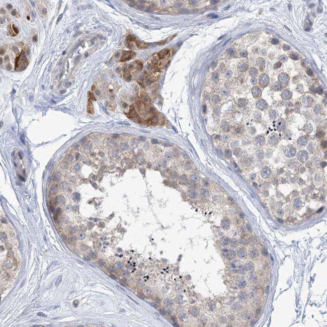 TTYH1 Antibody in Immunohistochemistry (IHC)