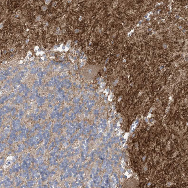 TTYH1 Antibody in Immunohistochemistry (IHC)