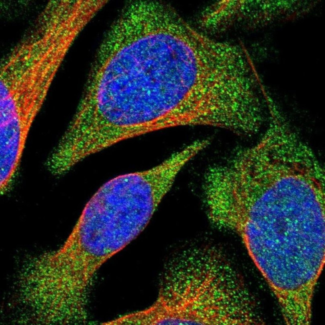 VPS9D1 Antibody in Immunocytochemistry (ICC/IF)