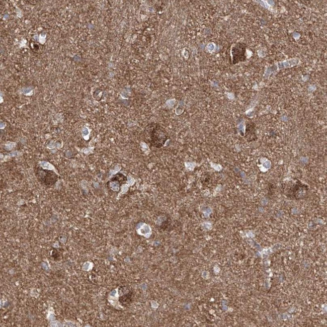 ZNF653 Antibody in Immunohistochemistry (IHC)