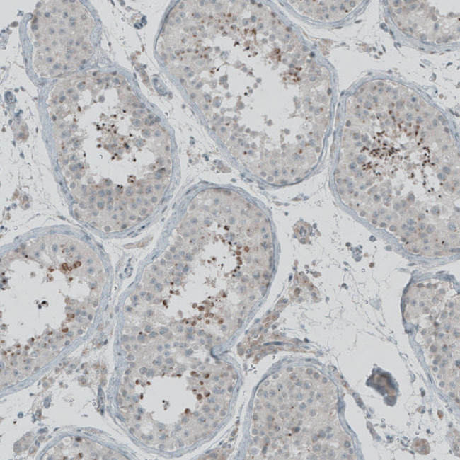 FBF1 Antibody in Immunohistochemistry (IHC)