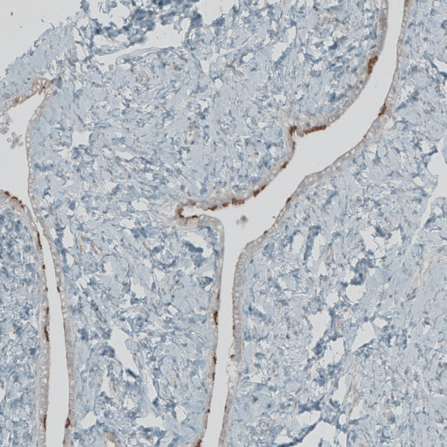 FBF1 Antibody in Immunohistochemistry (IHC)