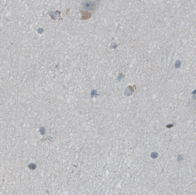 FBF1 Antibody in Immunohistochemistry (IHC)