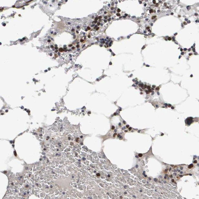 CDCA5 Antibody in Immunohistochemistry (IHC)