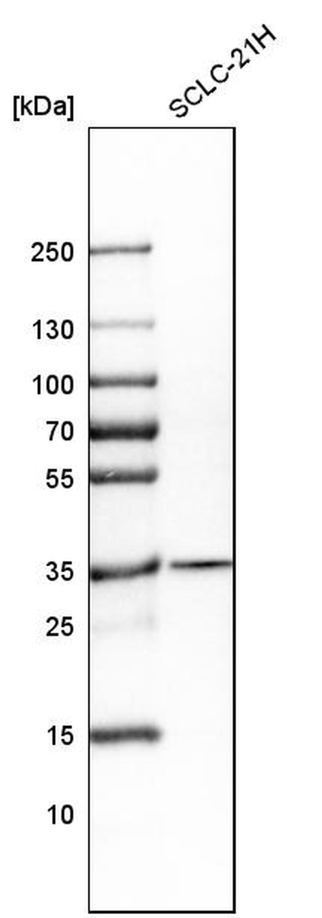 CDCA5 Antibody in Western Blot (WB)