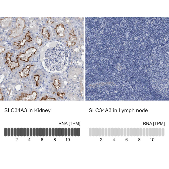 SLC34A3 Antibody in Immunohistochemistry (IHC)