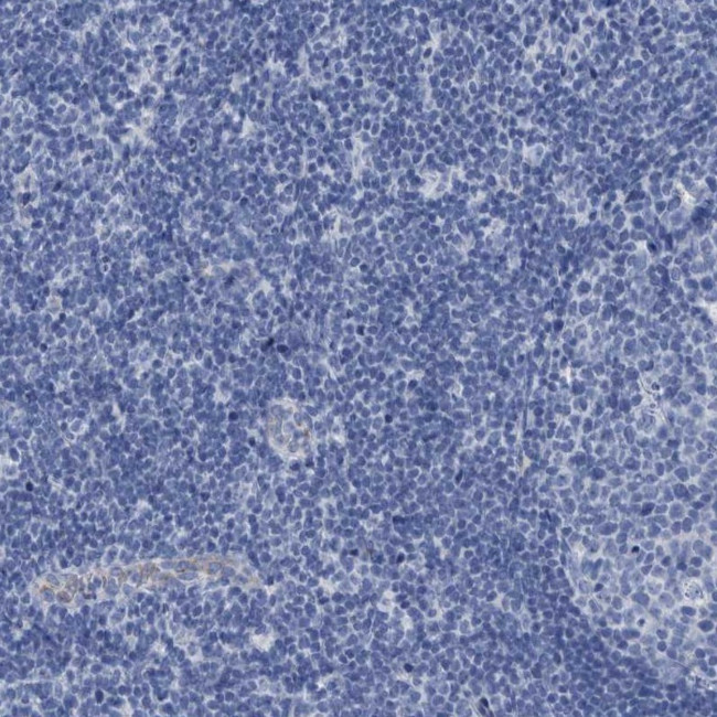 SLC34A3 Antibody in Immunohistochemistry (IHC)