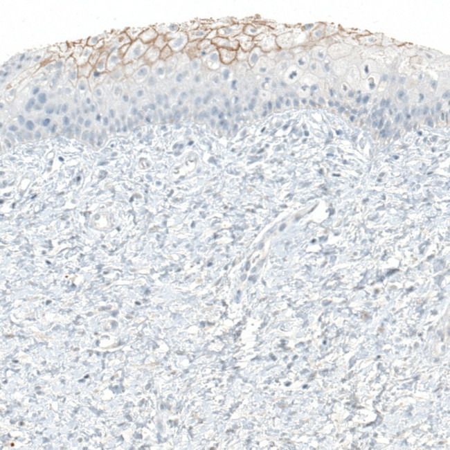 COL14A1 Antibody in Immunohistochemistry (IHC)