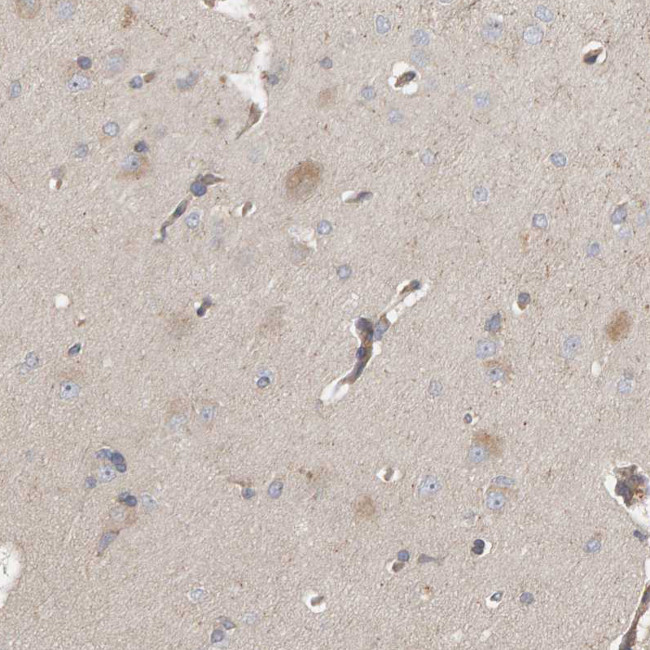 C9orf72 Antibody in Immunohistochemistry (IHC)