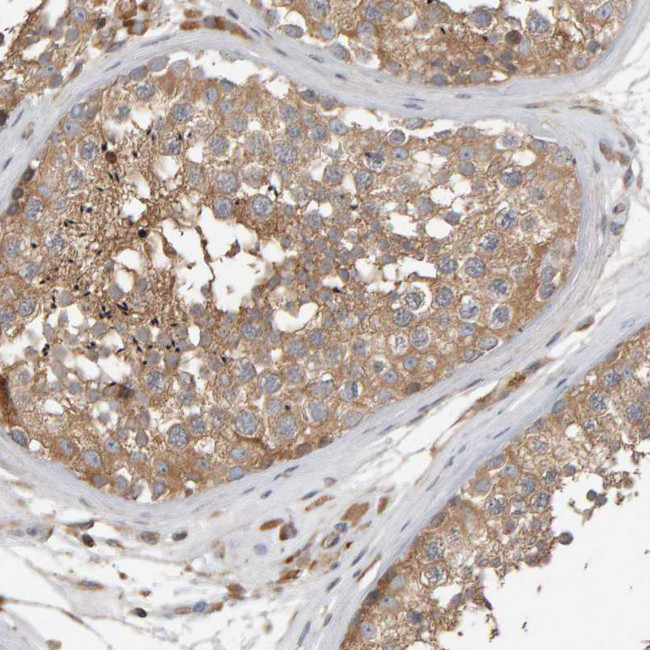 C9orf72 Antibody in Immunohistochemistry (IHC)