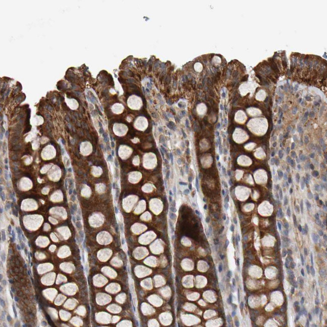 C9orf72 Antibody in Immunohistochemistry (IHC)