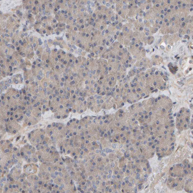 C9orf72 Antibody in Immunohistochemistry (IHC)