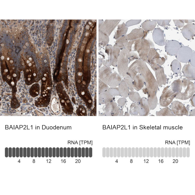 BAIAP2L1 Antibody in Immunohistochemistry (IHC)