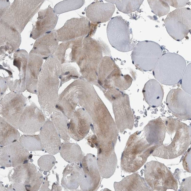 BAIAP2L1 Antibody in Immunohistochemistry (IHC)